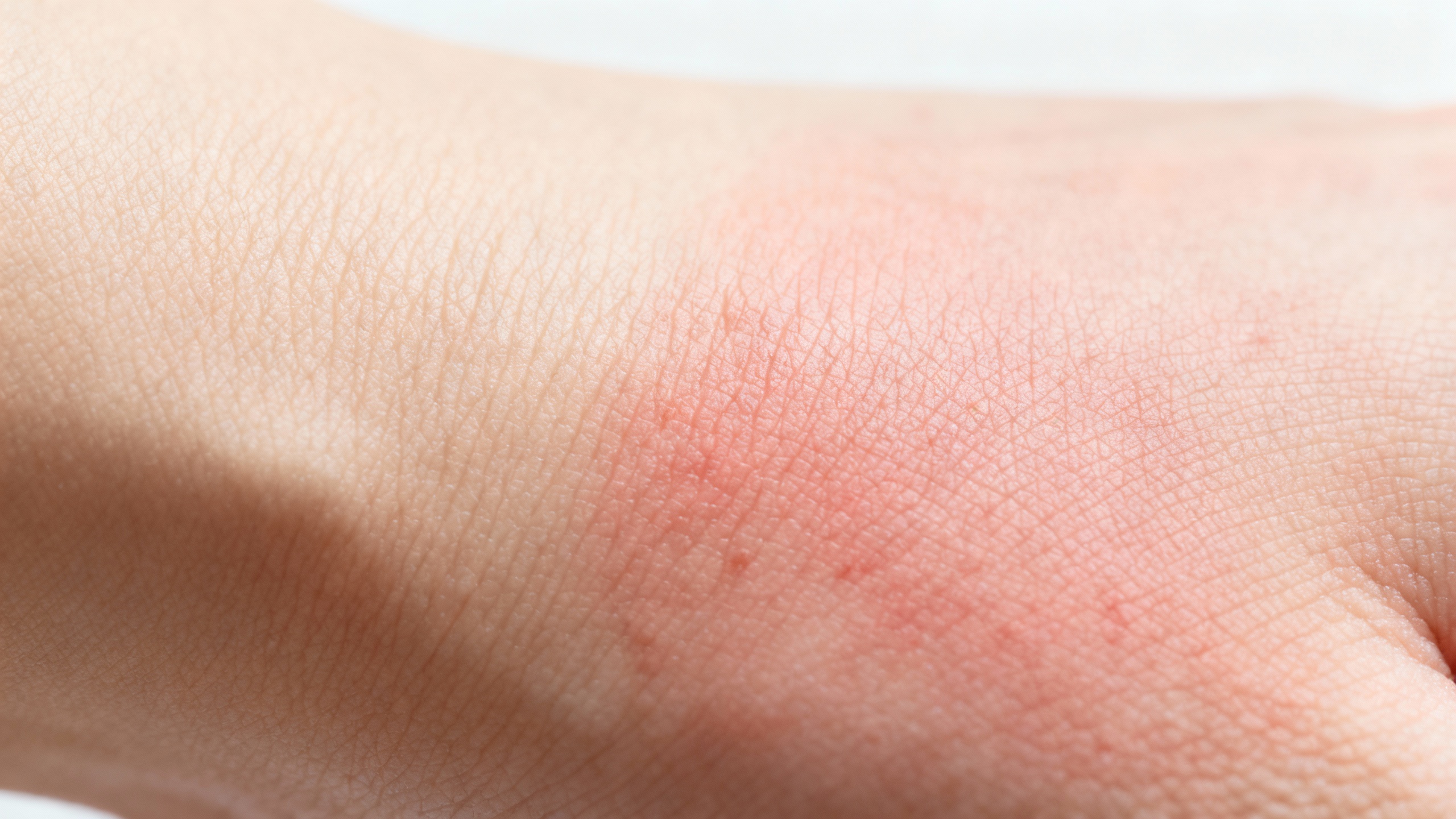 Featured image for From Symptoms to Sources: Detecting Dermatitis Causes